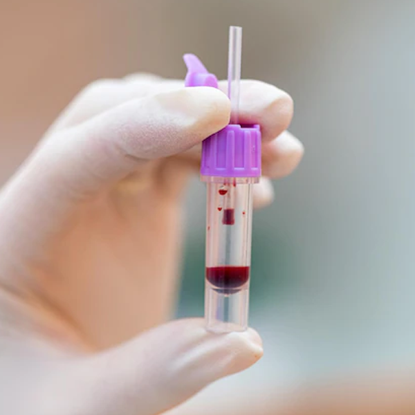 analisis clinicos farmacia sara granche sant boi de llobregat
